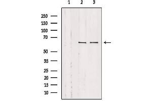 Western blot analysis of extracts from various samples, using SLC9A9 Antibody. (SLC9A9 Antikörper  (Internal Region))