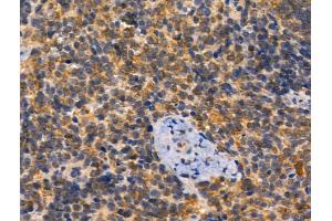 anti-Amyloid beta Precursor Protein (Cytoplasmic Tail) Binding Protein 2 (APPBP2) (Internal Region) antibody