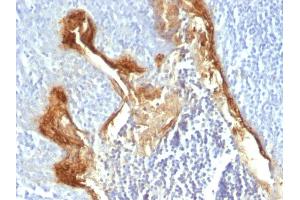 Formalin-fixed, paraffin-embedded human Tonsil stained with Involucrin Monoclonal Antibody (IVRN/827) (Involucrin Antikörper)