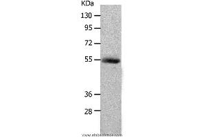 Western blot analysis of Human colon cancer tissue, using MMP17 Polyclonal Antibody at dilution of 1:550 (MMP17 Antikörper)
