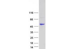 Validation with Western Blot (PTPRO Protein (Transcript Variant 3) (Myc-DYKDDDDK Tag))