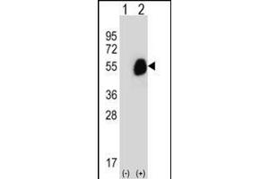 Western blot analysis of GCDH (arrow) using rabbit polyclonal GCDH Antibody (C-term) (ABIN656829 and ABIN2846038). (GCDH Antikörper  (C-Term))