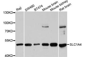 Western blot analysis of extracts of various cells, using SLC1A4 antibody. (SLC1A4 Antikörper)