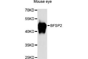 Western blot analysis of extracts of mouse eye, using BFSP2 antibody (ABIN6290111) at 1:3000 dilution. (BFSP2 Antikörper)