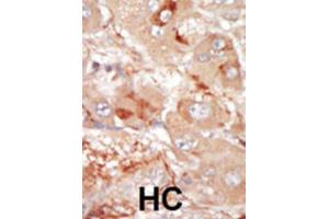 Immunohistochemistry (IHC) image for anti-Serine/threonine-Protein Kinase PRP4 Homolog (PRPF4B) antibody (ABIN3003283) (PRPF4B Antikörper)