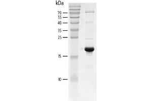 Recombinant PCAF (715-829) protein gel. (KAT2B Protein (AA 715-829) (His tag,DYKDDDDK Tag))