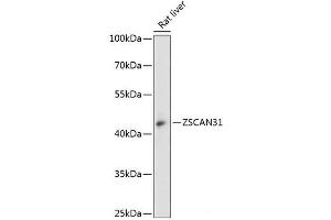 Western blot analysis of extracts of Rat liver using ZSCAN31 Polyclonal Antibody at dilution of 1:3000. (ZKSCAN2 Antikörper)