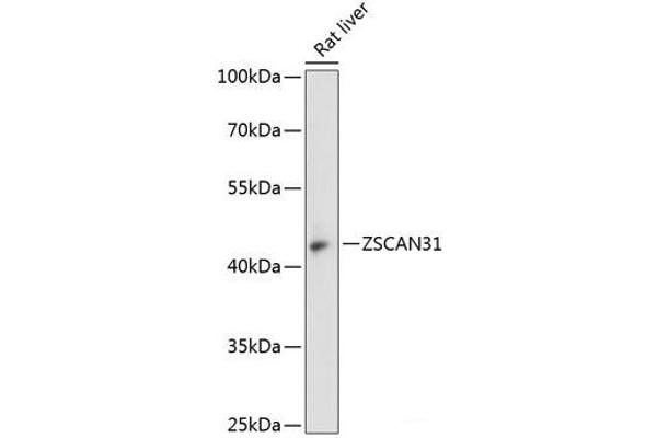 ZKSCAN2 Antikörper