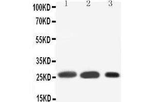 Anti-SFTPA1 antibody, Western blotting Lane 1: Rat Lung Tissue Lysate Lane 2: Rat Lung Tissue Lysate Lane 3: MK(55KD) (Surfactant Protein A1 Antikörper  (C-Term))