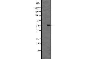 Western blot analysis of DRD5 expression in HEK293 cells ,The lane on the left is treated with the antigen-specific peptide. (DRD5 Antikörper  (N-Term))