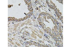 Immunohistochemistry (Paraffin-embedded Sections) (IHC (p)) image for anti-Transmembrane Channel-Like 1 (TMC1) antibody (ABIN7264647)