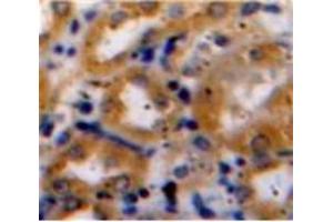 anti-Collagen, Type XV (COL15) (AA 1212-1388) antibody