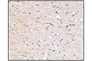 Immunohistochemical staining of human brain tissue using AP30769PU-N at 2. (FBXL20 Antikörper  (N-Term))
