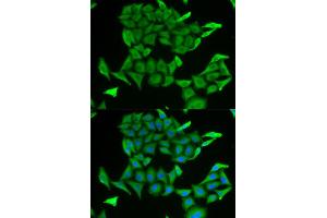 Immunofluorescence (IF) image for anti-MB antibody (ABIN1876659) (MB Antikörper)