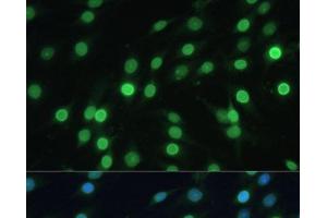Immunofluorescence analysis of C6 cells using LBR Polyclonal Antibody at dilution of 1:100 (40x lens). (Lamin B Receptor Antikörper)