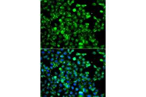 Immunofluorescence analysis of A549 cells using CAPN5 antibody. (Calpain 5 Antikörper  (AA 361-640))