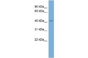 WB Suggested Anti-TRIM44 Antibody Titration: 0.