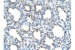 SLC15A4 antibody was used for immunohistochemistry at a concentration of 4-8 ug/ml to stain Alveolar cells (arrows) in Human Lung.