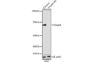 Western blot analysis of extracts from wild type (WT) and Smad4 knockout (KO) 293T cells, using Smad4 antibody (ABIN7270340) at 1:1000 dilution. (SMAD4 Antikörper)