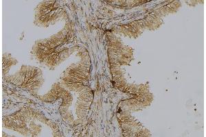 ABIN6278443 at 1/100 staining Mouse colon tissue by IHC-P.