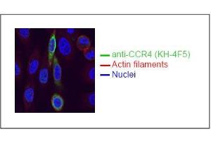Spectral Confocal Microscopy of CHO cells using KH-4F5. (CCR4 Antikörper)