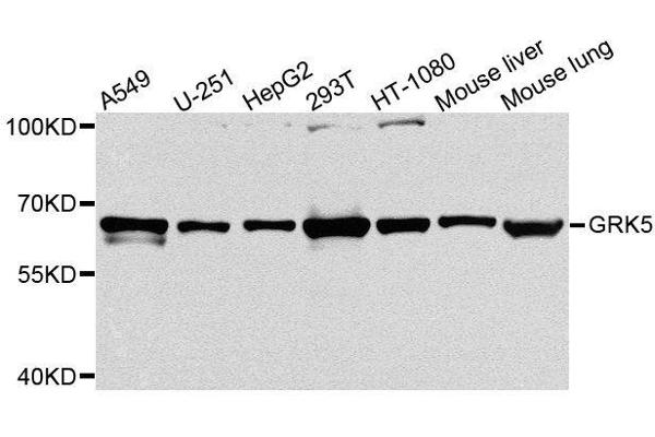 GRK5 anticorps  (AA 371-590)