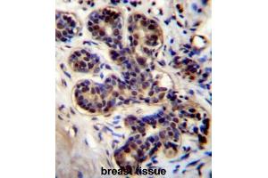 PROX2 Antibody (C-term) immunohistochemistry analysis in formalin fixed and paraffin embedded human breast tissue followed by peroxidase conjugation of the secondary antibody and DAB staining. (PROX2 Antikörper  (C-Term))