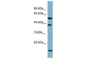 SLC10A1 antibody used at 1 ug/ml to detect target protein.