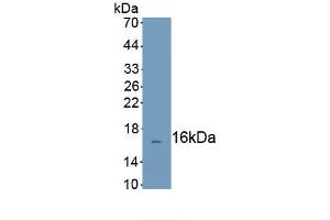 Detection of Recombinant CFHR3, Human using Polyclonal Antibody to Complement Factor H Related Protein 3 (CFHR3) (CFHR3 Antikörper  (AA 208-330))