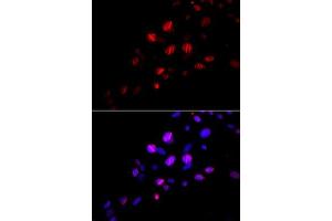 Immunofluorescence analysis of U2OS cell using RAD18 antibody. (RAD18 Antikörper)