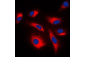 Immunofluorescent analysis of Caspase 6 p18 staining in NIH3T3 cells. (Caspase 6 p18 (Center) Antikörper)