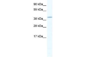 WB Suggested Anti-GATA5 Antibody Titration:  1. (GATA5 Antikörper  (C-Term))