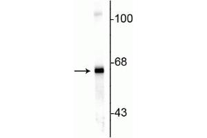 Western blot of rat cortex lysate showing specific immunolabeling of the ~ 66 kDa alpha internexin protein.