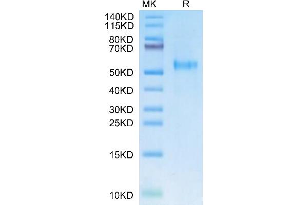 KIR3DL2 Protein (AA 22-338) (His tag)
