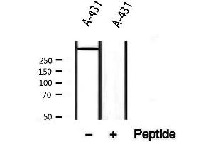 Western blot analysis of extracts from A431, using DST Antibody. (Dystonin Antikörper  (C-Term))