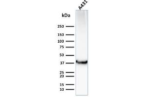 Western Blot Analysis of Human A431 cell lysate using GLUT-1 Mouse Monoclonal Antibody (GLUT1/2476). (GLUT1 Antikörper  (AA 203-305))