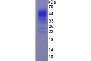 Image no. 1 for Interferon gamma (IFNG) (AA 24-166) (Active) protein (His tag) (ABIN6239726) (Interferon gamma Protein (IFNG) (AA 24-166) (His tag))
