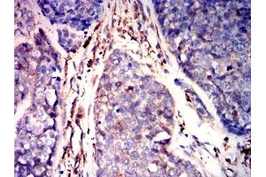 Immunohistochemistry (IHC) image for anti-Gelsolin (GSN) antibody (ABIN7193641)