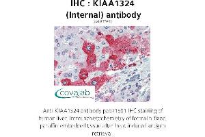 Image no. 2 for anti-Endosome/Lysosome-associated Apoptosis and Autophagy Regulator 1 (ELAPOR1) (Internal Region) antibody (ABIN1736215)