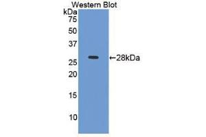 Western blot analysis of recombinant Mouse ICAM4. (ICAM4 Antikörper  (AA 23-227))