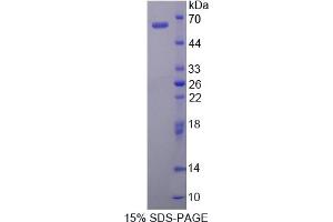 Image no. 1 for Protein Red (IK) (AA 1-192) protein (His tag,GST tag) (ABIN4991058)