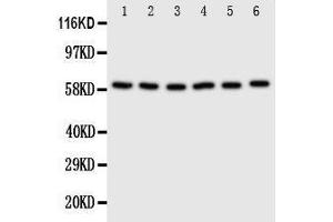Anti-SCLY antibody, Western blotting Lane 1: U87 Cell Lysate Lane 2: HELA Cell Lysate Lane 3: 293T Cell Lysate Lane 4: MCF-7 Cell Lysate Lane 5: COLO320 Cell Lysate Lane 6:  Cell Lysate