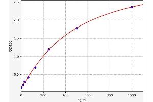 EPRS ELISA Kit