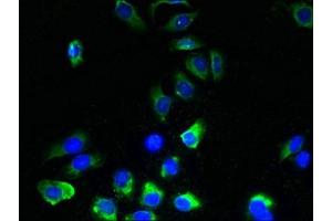 Immunofluorescent analysis of A549 cells using ABIN7173167 at dilution of 1:100 and Alexa Fluor 488-congugated AffiniPure Goat Anti-Rabbit IgG(H+L) (TMEM243 Antikörper  (AA 1-31))