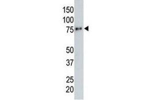 Anti-HA tag antibody testing a tagged recombinant protein. (HA-Tag Antikörper)