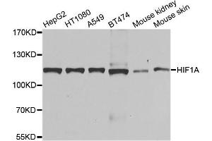 Western blot analysis of extracts of various cell lines, using HIF1A antibody. (HIF1A Antikörper)