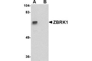 Western blot analysis of ZBRK1 in A-20 lysate with this product at 1 μg/ml in (A) the absence and (B) the presence of blocking peptide. (ZNF350 Antikörper  (C-Term))