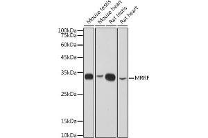 Western blot analysis of extracts of various cell lines, using MRRF antibody (ABIN7268589) at 1:1000 dilution. (MRRF Antikörper)