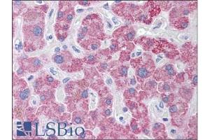 Human Liver: Formalin-Fixed, Paraffin-Embedded (FFPE)