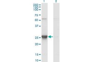 Western Blot analysis of TK1 expression in transfected 293T cell line by TK1 monoclonal antibody (M12), clone 3A8. (TK1 Antikörper  (AA 1-234))